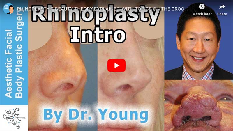 RHINOPLASTY & BEAUTY THEORY EXPLAINED, WITH TOPICS ON THE CROOKED NOSE, NASAL HUMPS, ASIAN NOSE